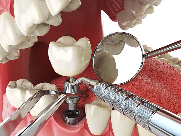 Best 24-Hour Emergency Dental Care in Lexington, TN
